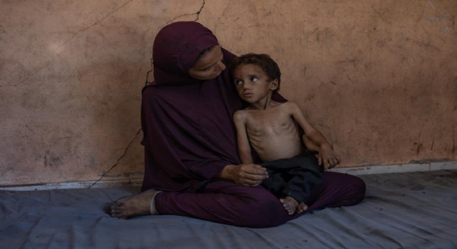 Gazze'de açlıktan ölenlerin sayısı 127'ye çıktı