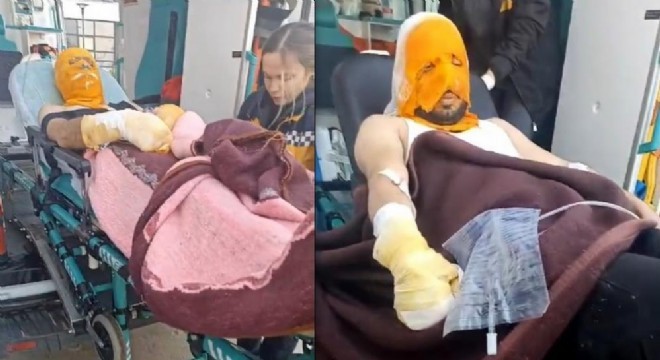 Çayırlı'da trafo patlaması: 2 yaralı